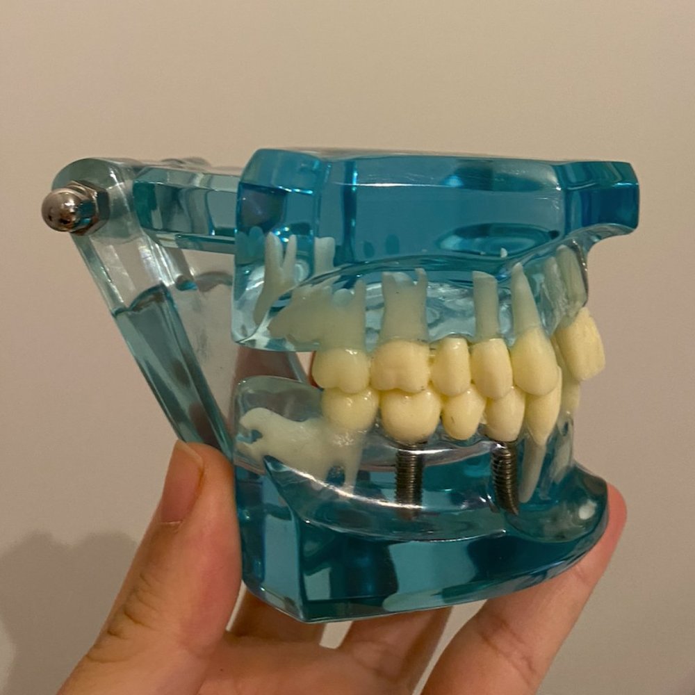 Typodont- Dental/ Teeth model